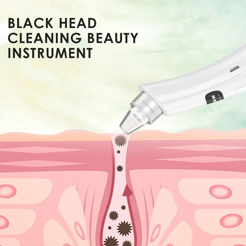 3-Mode Blackhead Remover – Deep Pore Cleansing & Skin Renewal Tool
